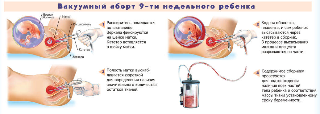 mini-abort